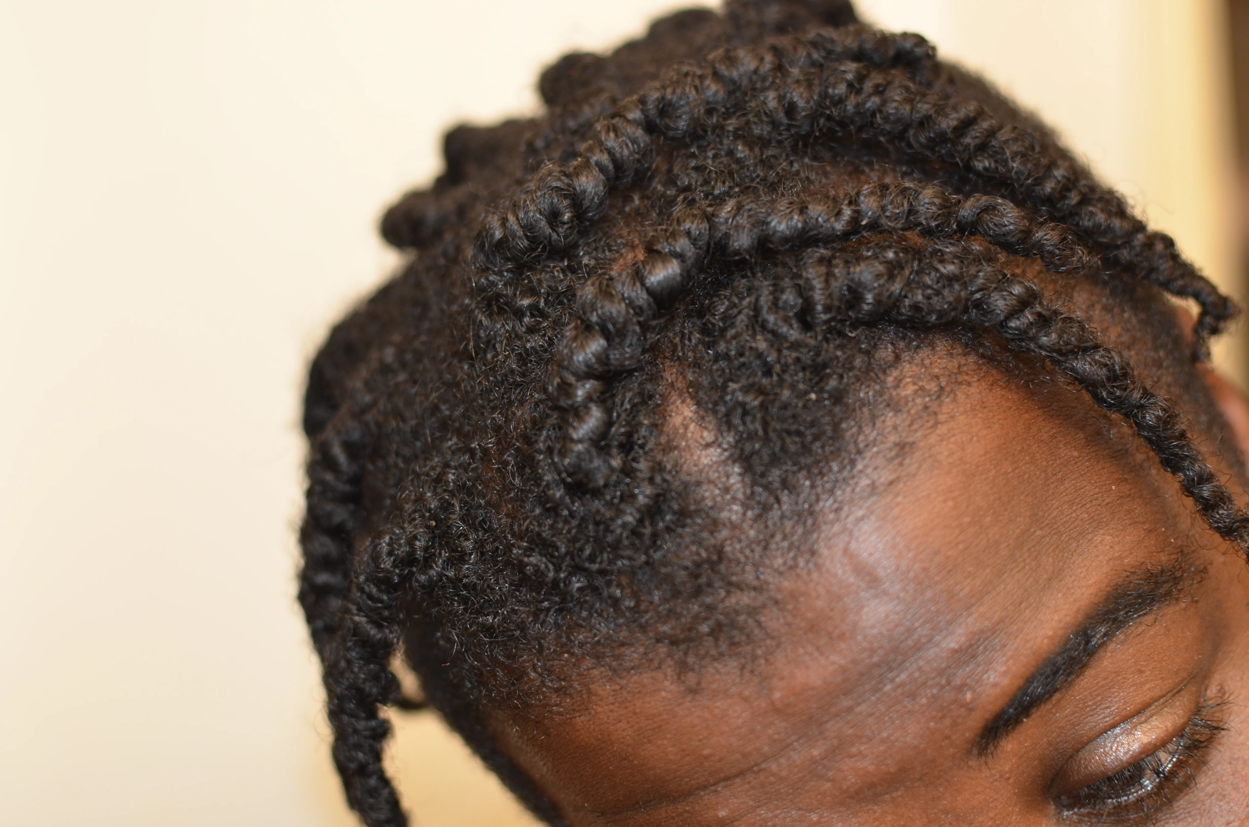 Botanical Baldness 🧑‍🦲 Buster w/ Stinging Nettles, Saw Palmetto, Rosemary | Hair Growth & Retention - Image 10