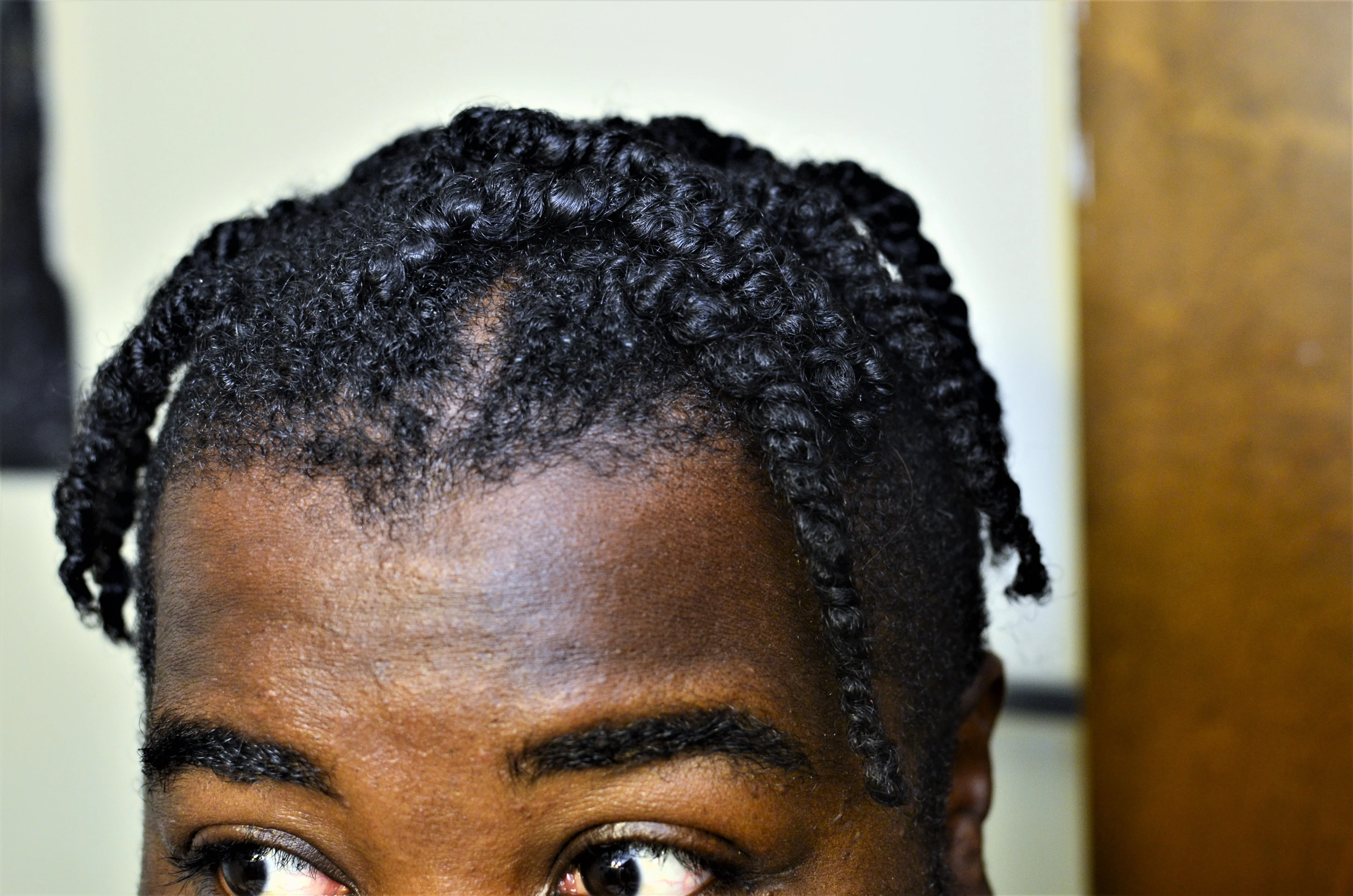 Botanical Baldness 🧑‍🦲 Buster w/ Stinging Nettles, Saw Palmetto, Rosemary | Hair Growth & Retention - Image 7
